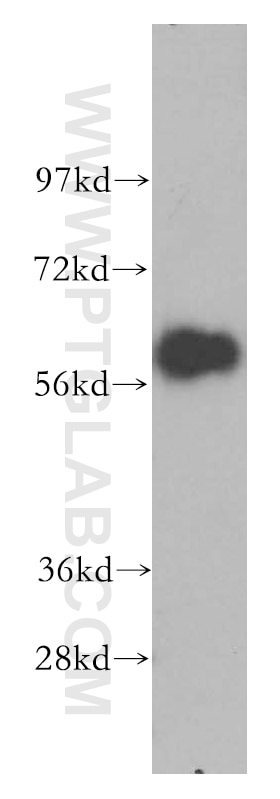 Western Blot (WB) analysis of MCF-7 cells using CREB5 Polyclonal antibody (14196-1-AP)