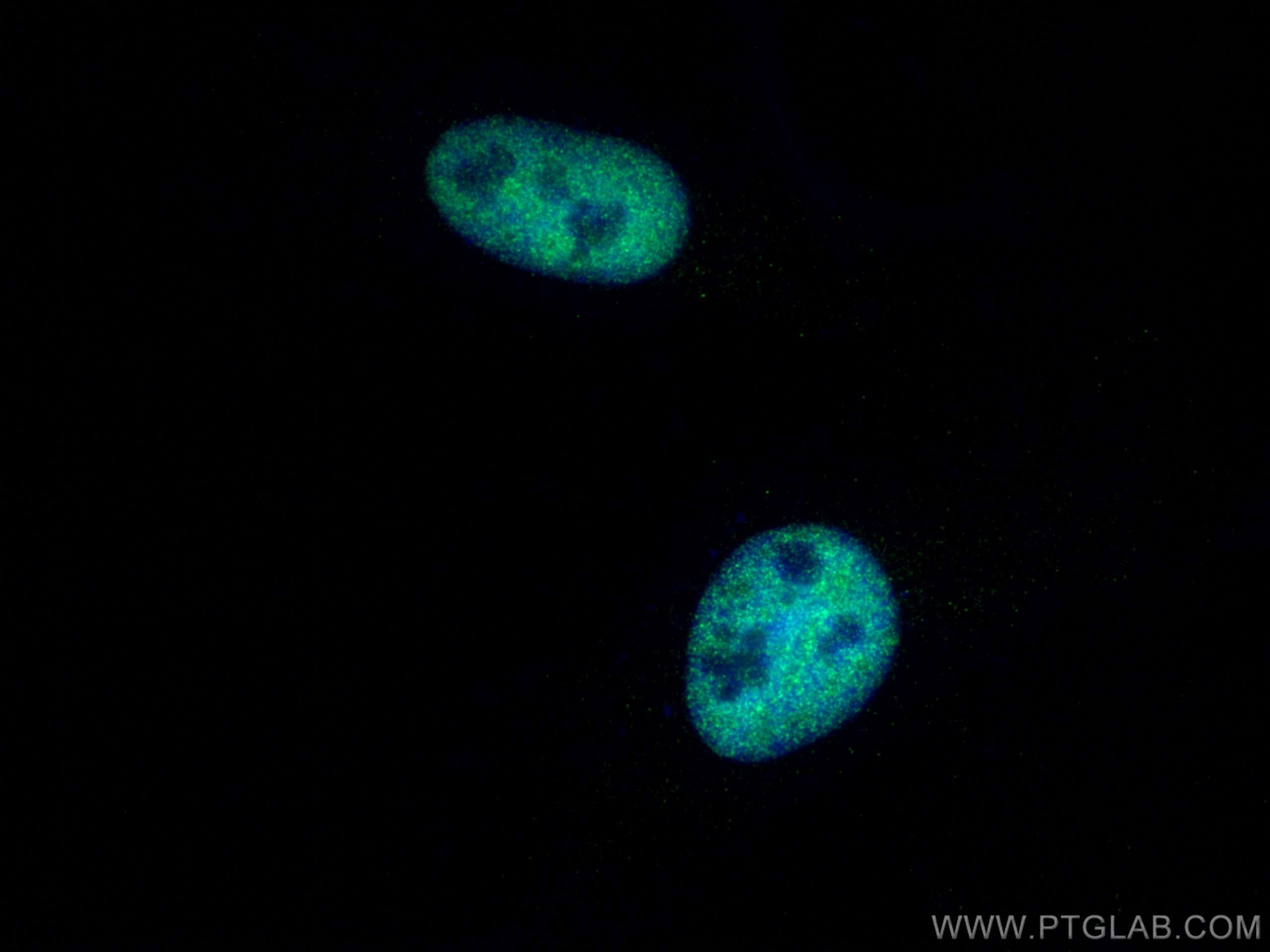 Immunofluorescence (IF) / fluorescent staining of HeLa cells using CREBBP Polyclonal antibody (22277-1-AP)