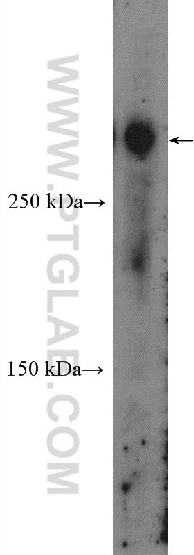 CREBBP Polyclonal antibody