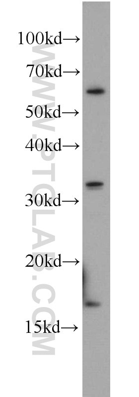 Western Blot (WB) analysis of mouse liver tissue using CREBL2 Polyclonal antibody (18007-1-AP)