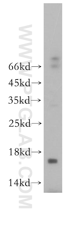 Western Blot (WB) analysis of human liver tissue using CREBL2 Polyclonal antibody (18007-1-AP)