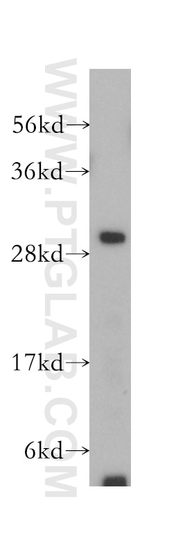 WB analysis of K-562 using 12220-1-AP