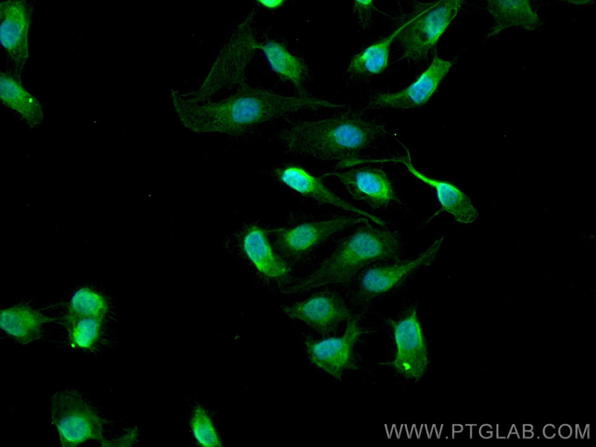 Immunofluorescence (IF) / fluorescent staining of U2OS cells using CRELD1 Polyclonal antibody (29903-1-AP)