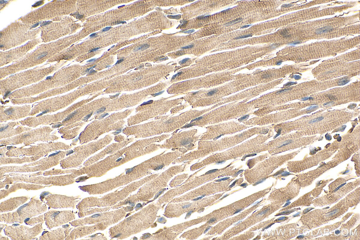 Immunohistochemistry (IHC) staining of mouse heart tissue using CRELD1 Polyclonal antibody (29903-1-AP)