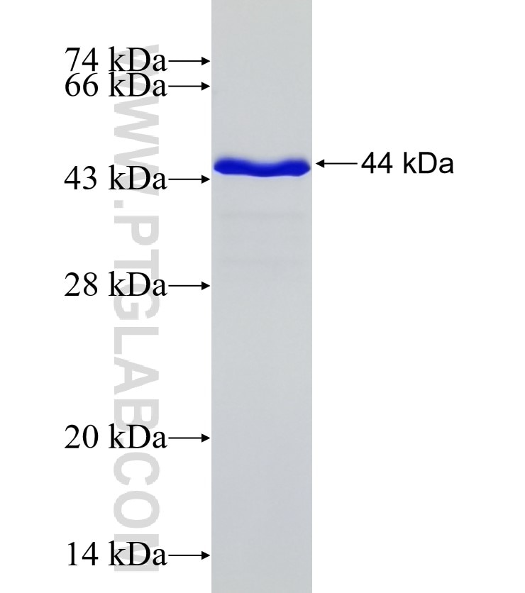 CRELD1 fusion protein Ag31593 SDS-PAGE