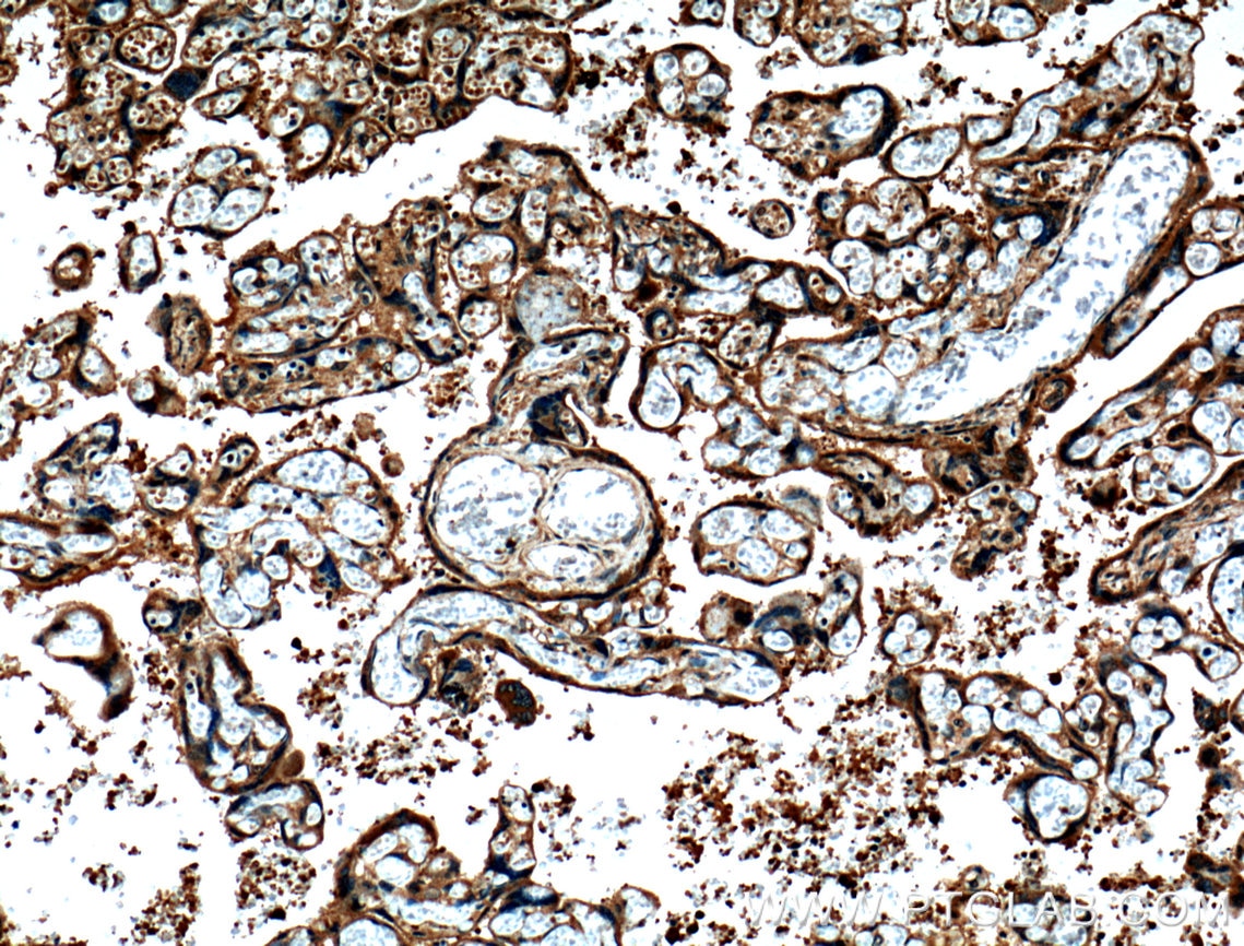 Immunohistochemistry (IHC) staining of human placenta tissue using CRELD2 Polyclonal antibody (27017-1-AP)