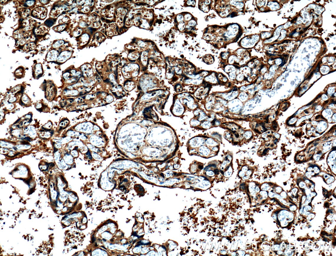 IHC staining of human placenta using 27017-1-AP