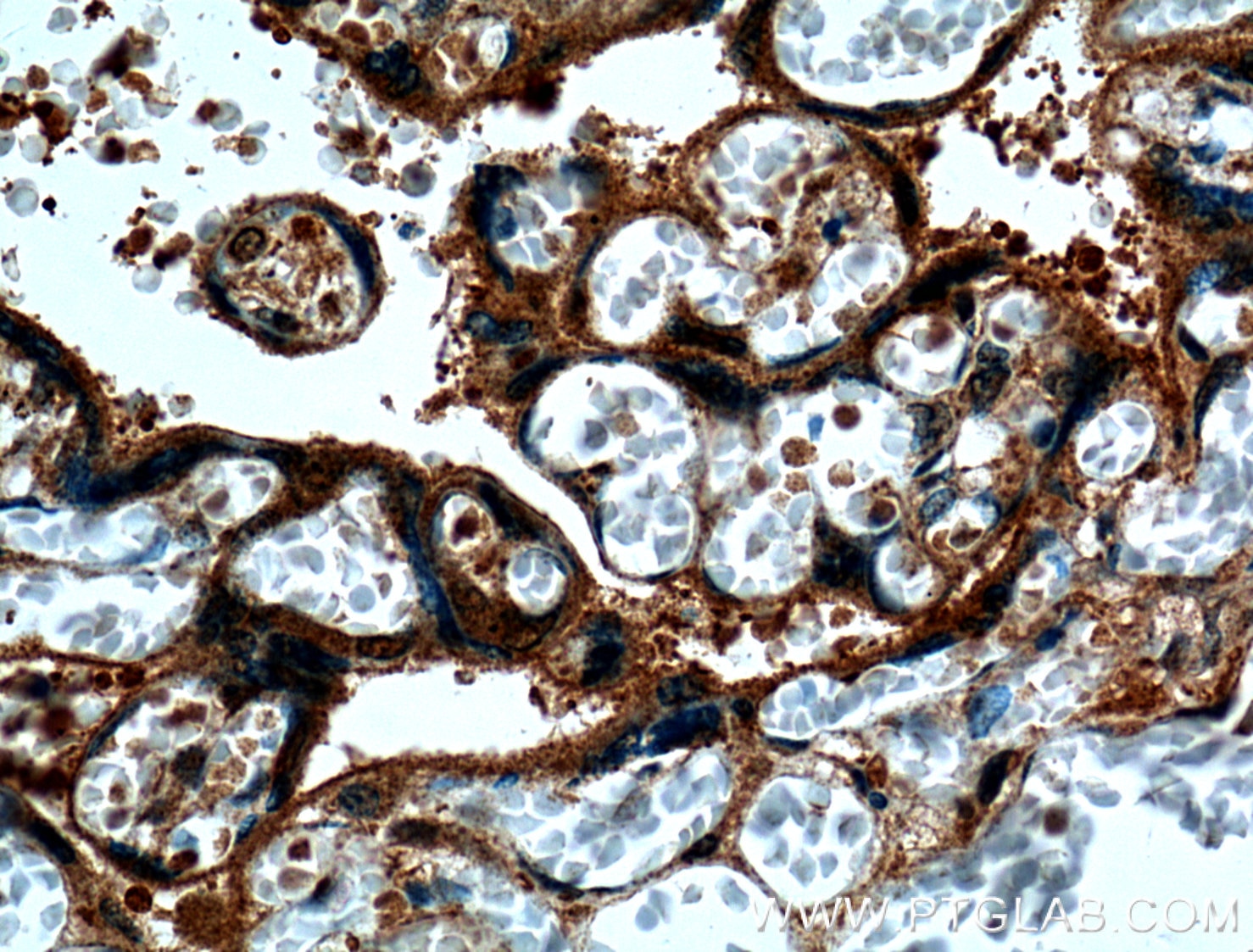 IHC staining of human placenta using 27017-1-AP