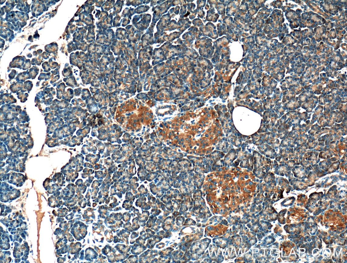 Immunohistochemistry (IHC) staining of human pancreas tissue using CRELD2 Polyclonal antibody (27017-1-AP)