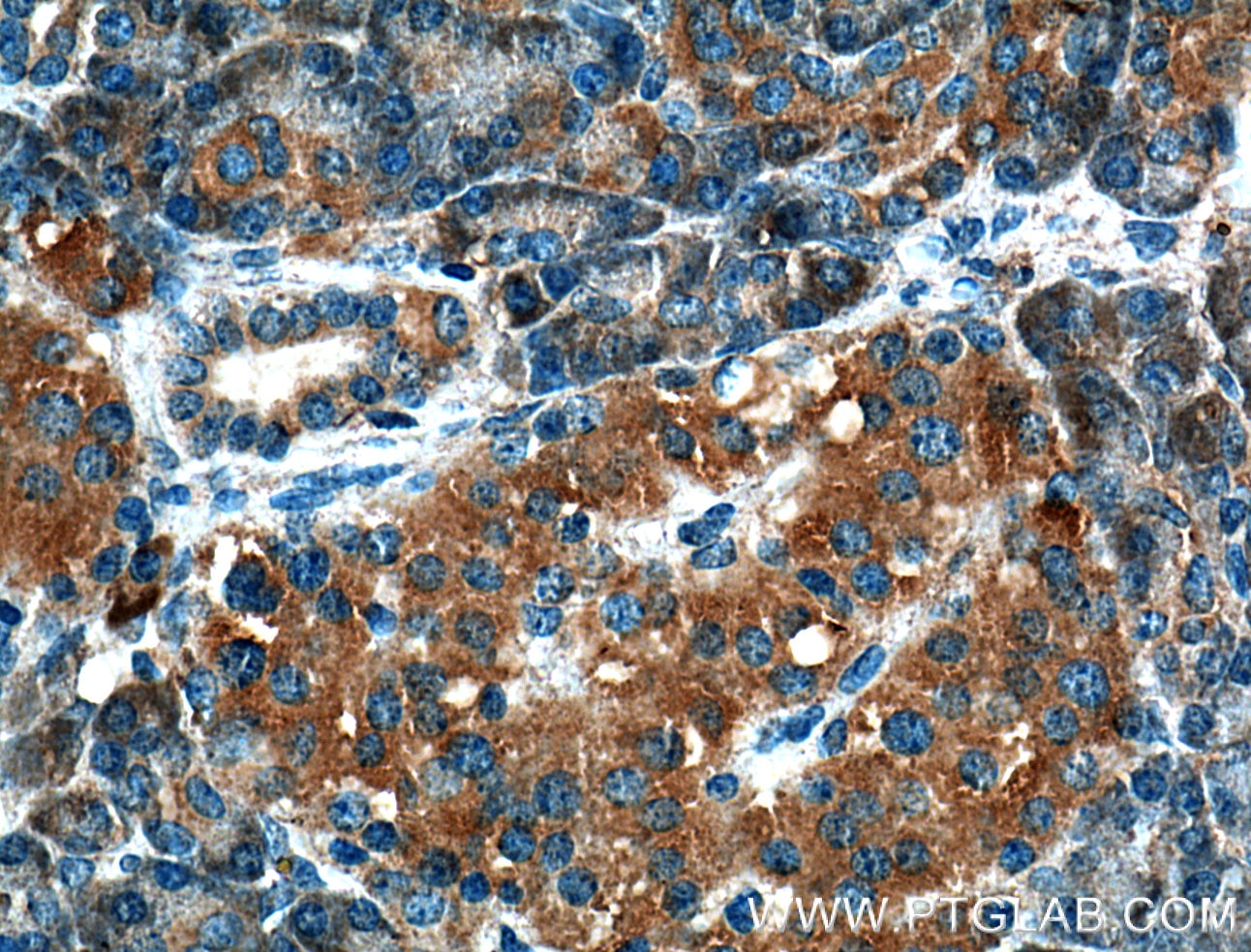 Immunohistochemistry (IHC) staining of human pancreas tissue using CRELD2 Polyclonal antibody (27017-1-AP)