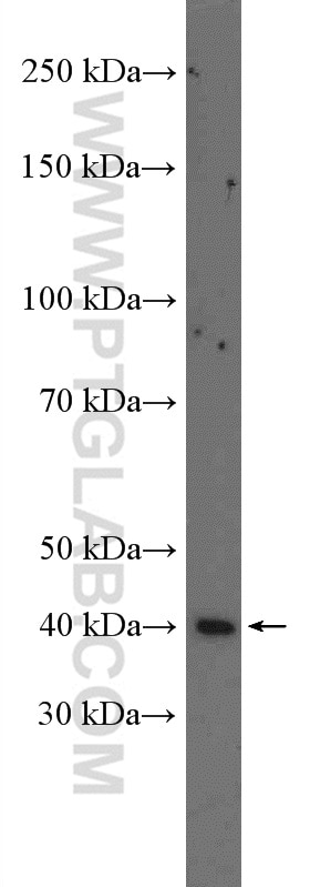 Western Blot (WB) analysis of SH-SY5Y cells using CRELD2 Polyclonal antibody (27017-1-AP)