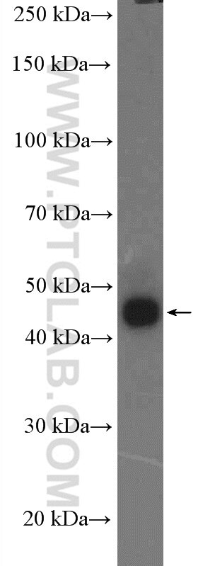 Western Blot (WB) analysis of human placenta tissue using CRELD2 Polyclonal antibody (27017-1-AP)