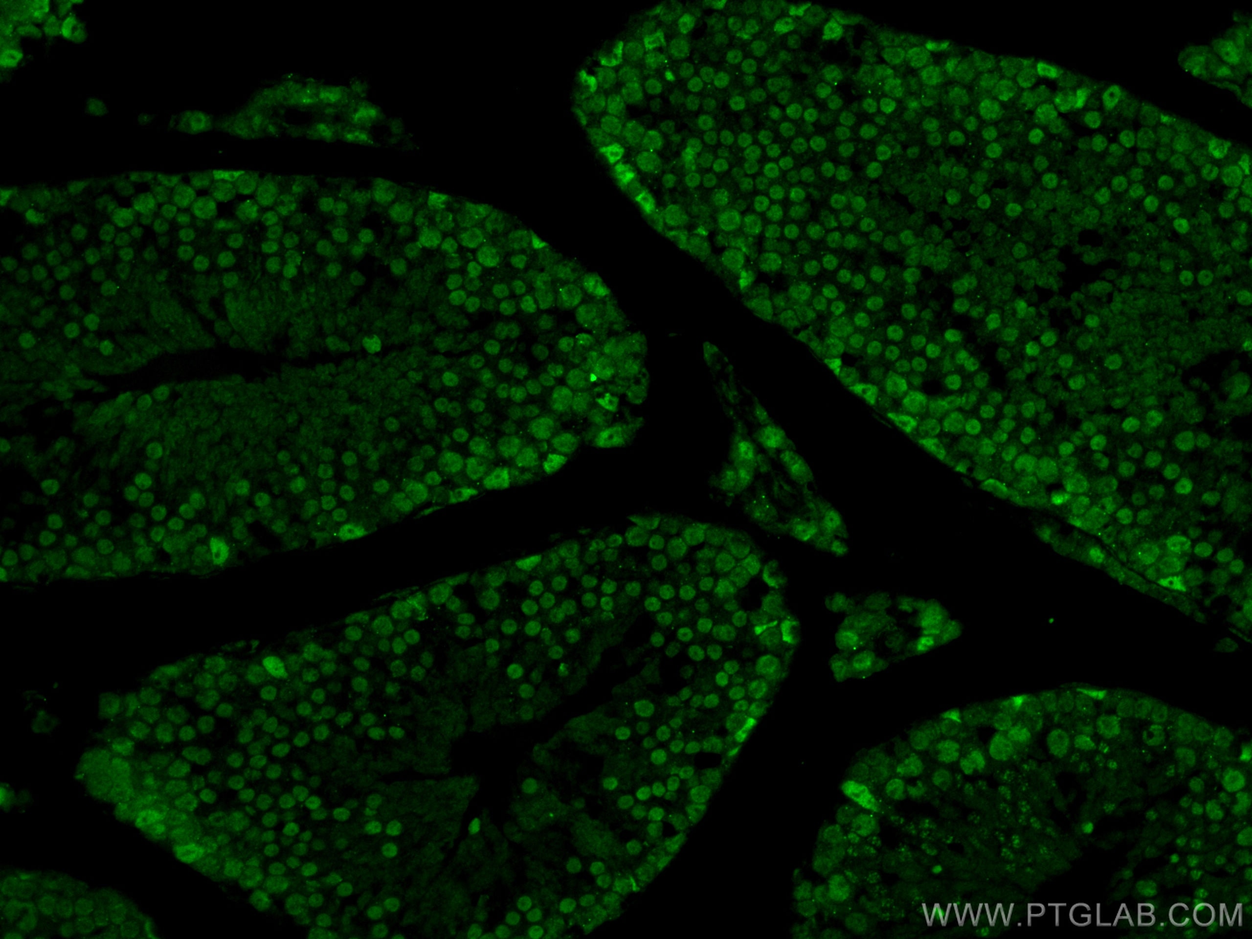 IF Staining of mouse testis using 12439-1-AP