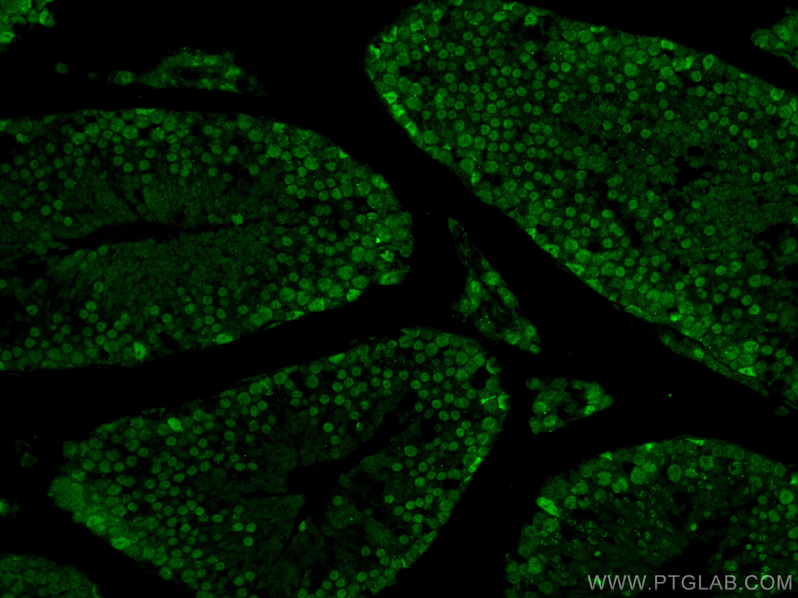 Immunofluorescence (IF) / fluorescent staining of mouse testis tissue using CREST Polyclonal antibody (12439-1-AP)