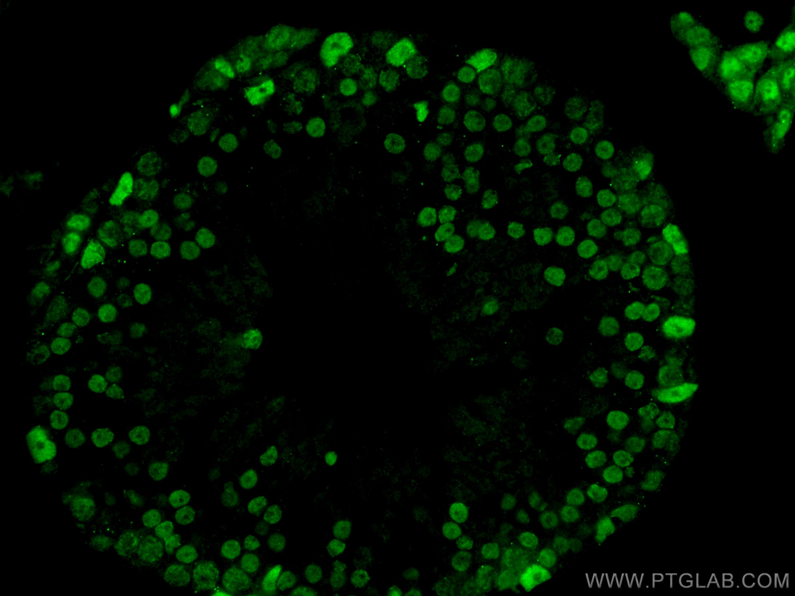 Immunofluorescence (IF) / fluorescent staining of mouse testis tissue using CREST Polyclonal antibody (12439-1-AP)