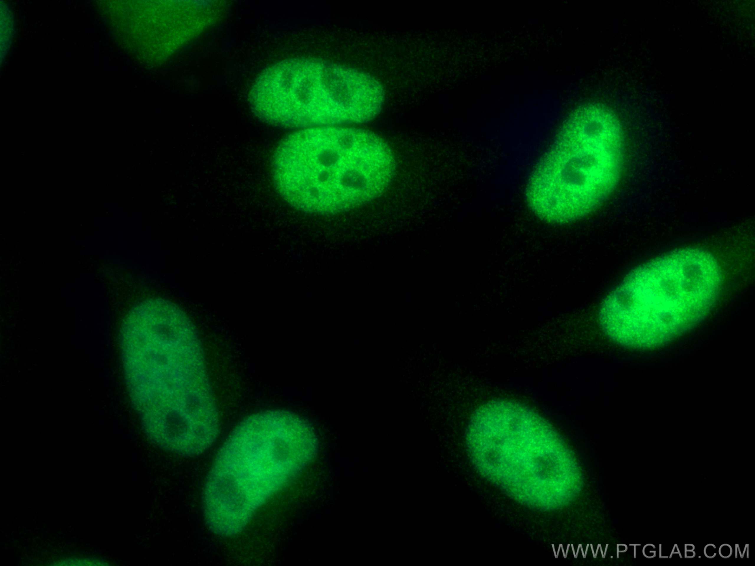 Immunofluorescence (IF) / fluorescent staining of HeLa cells using CREST Polyclonal antibody (12439-1-AP)