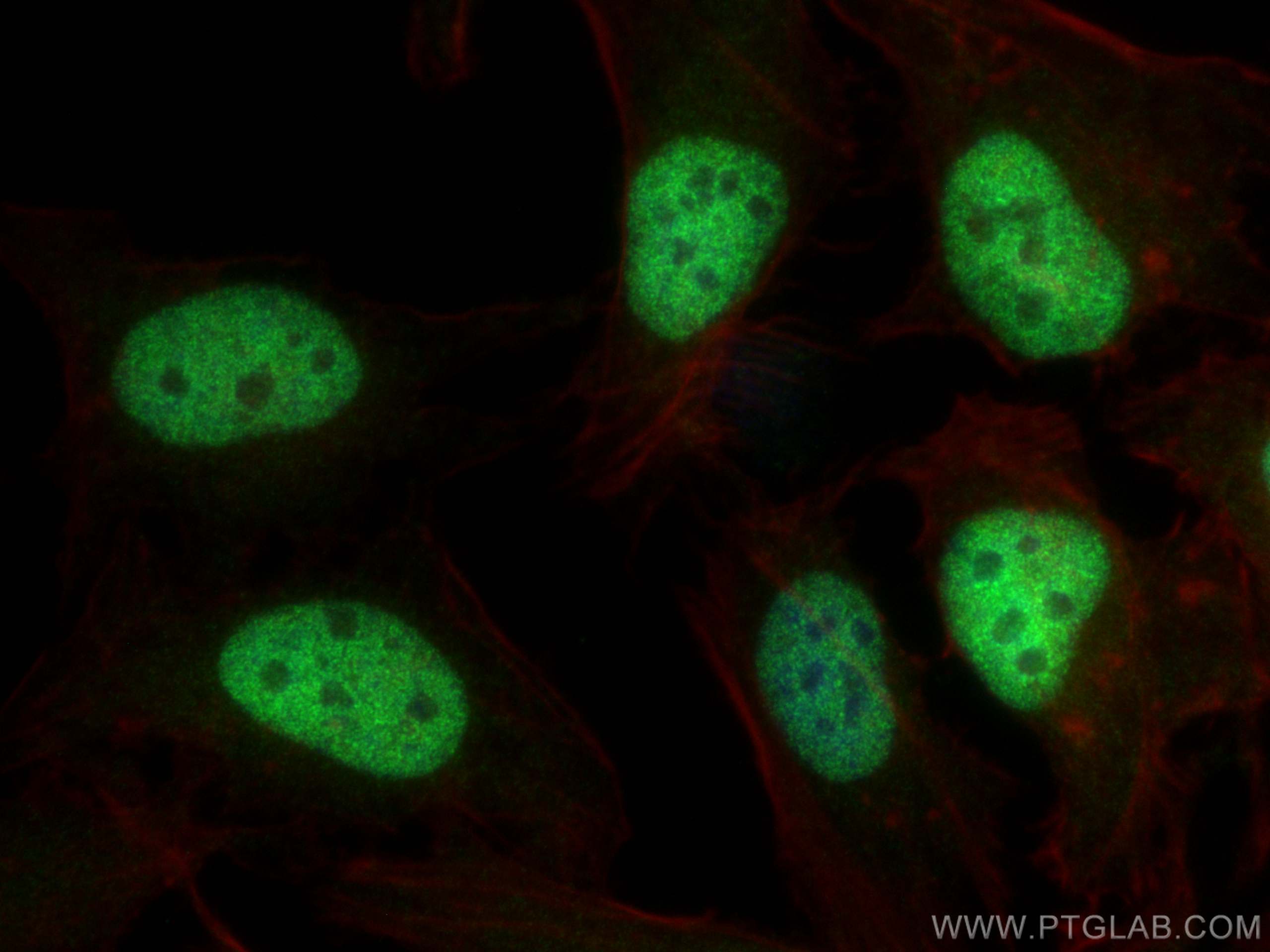 Immunofluorescence (IF) / fluorescent staining of HeLa cells using CREST Polyclonal antibody (12439-1-AP)