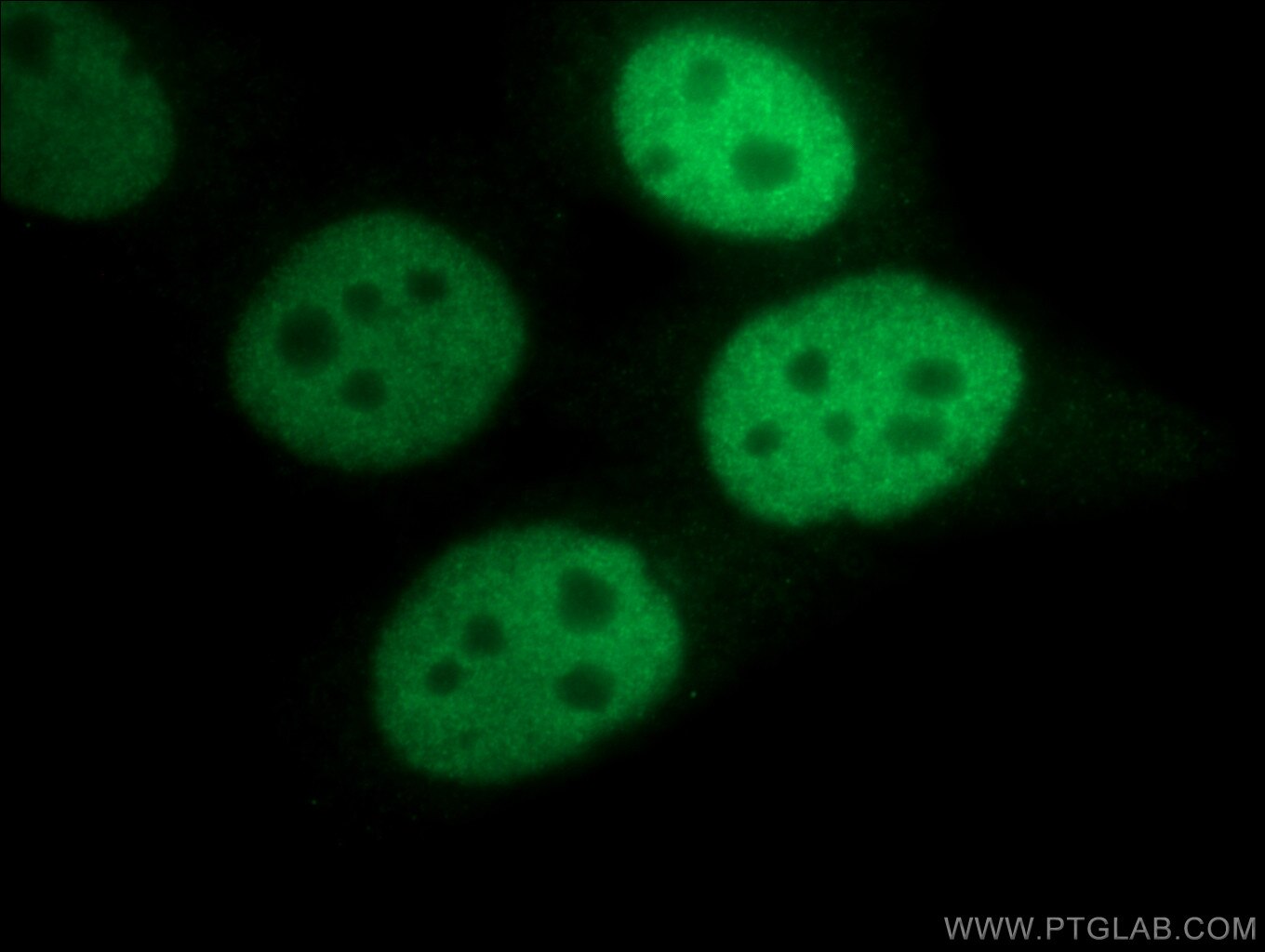 IF Staining of HeLa using 12439-1-AP