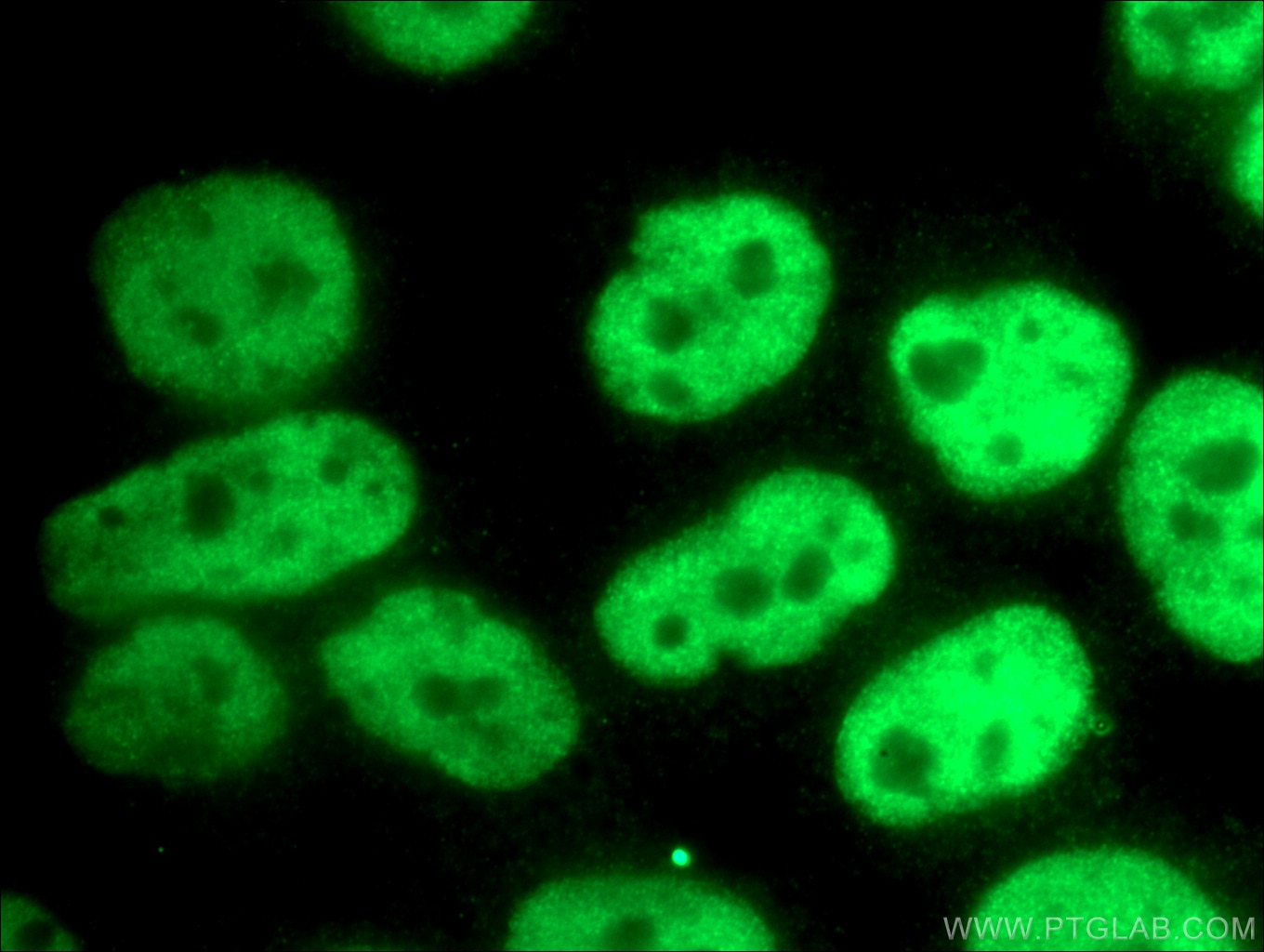 Immunofluorescence (IF) / fluorescent staining of HeLa cells using CREST Polyclonal antibody (12439-1-AP)