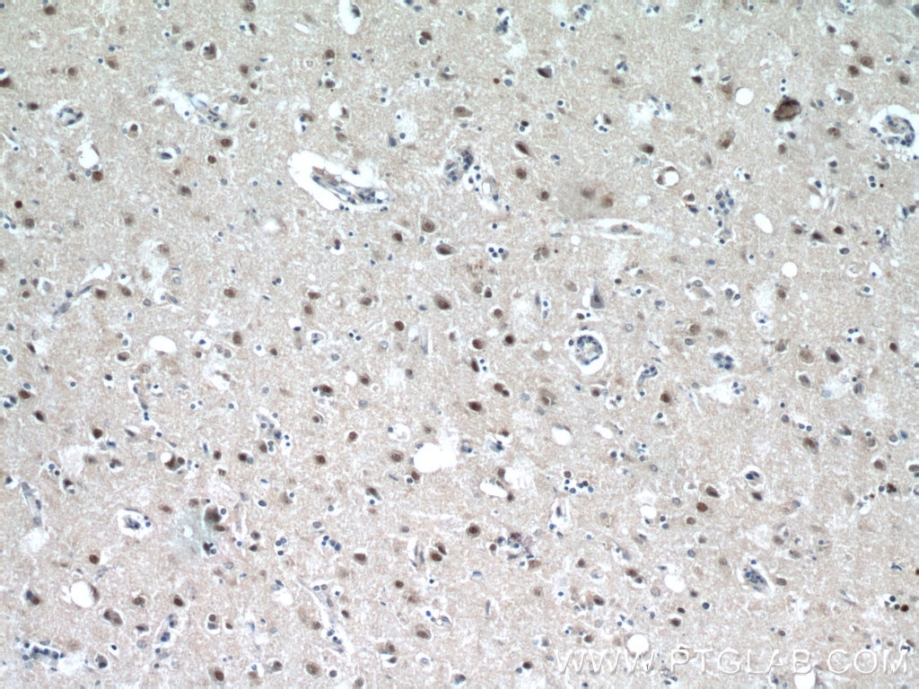 IHC staining of human brain using 12439-1-AP