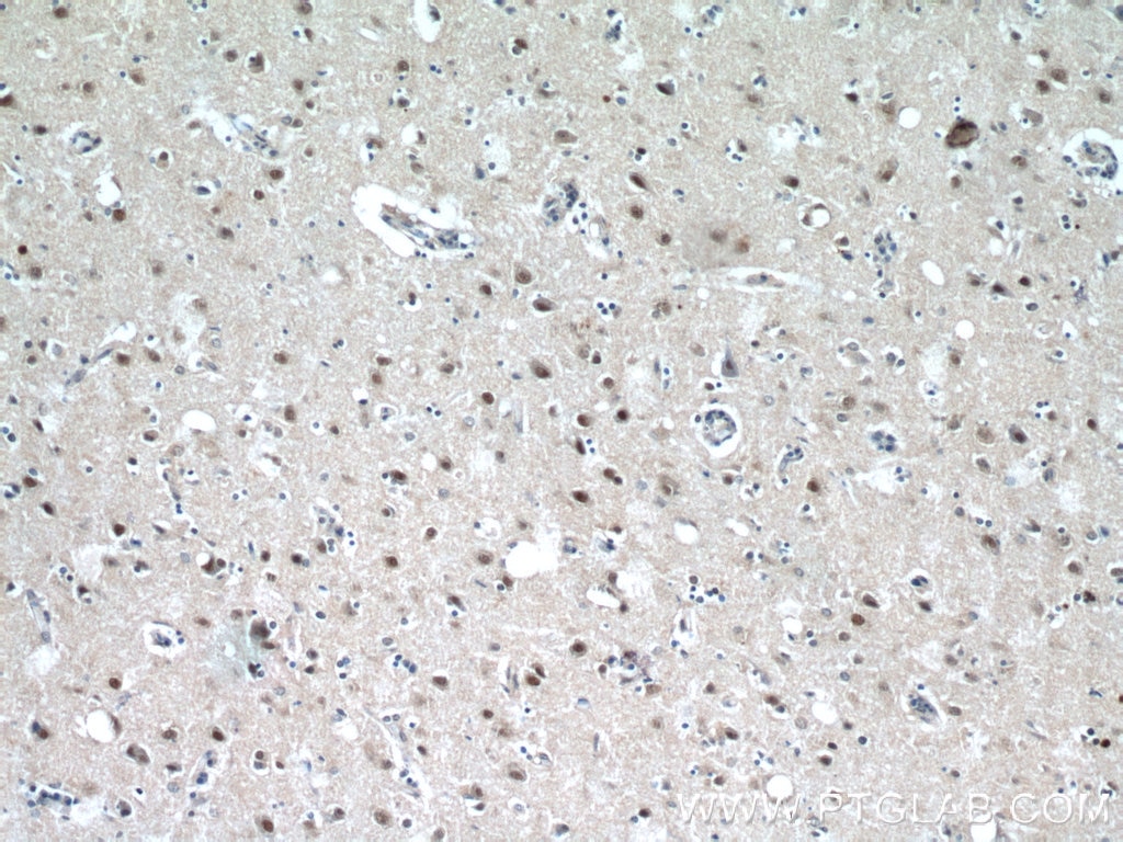 Immunohistochemistry (IHC) staining of human brain tissue using CREST Polyclonal antibody (12439-1-AP)