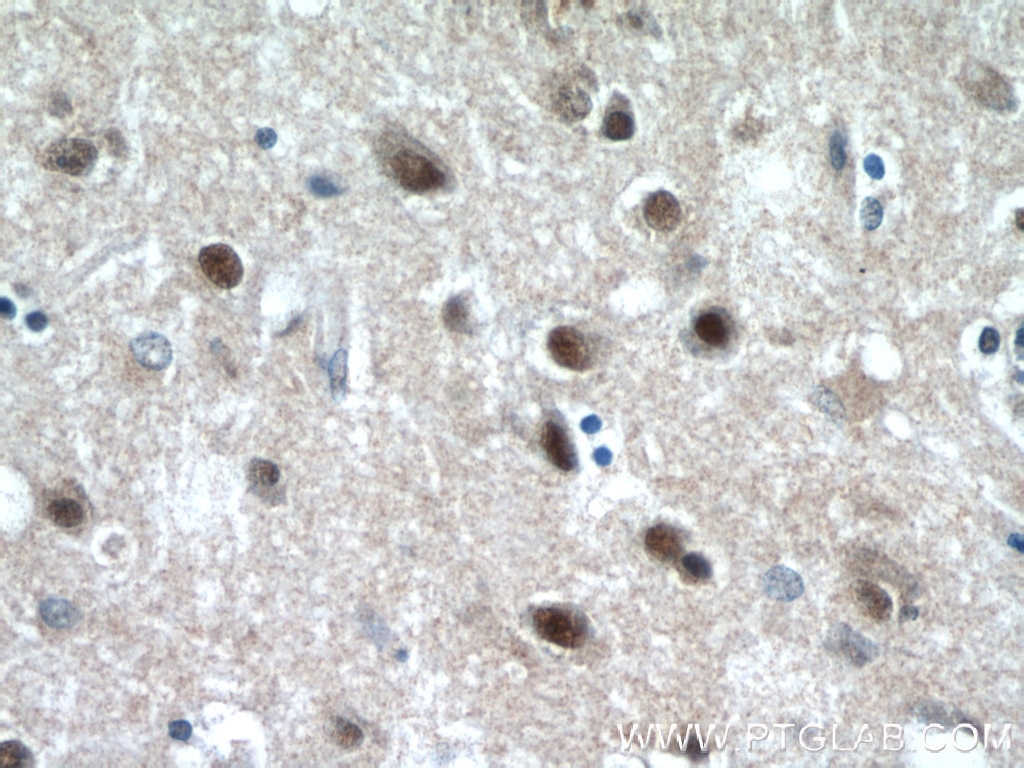 Immunohistochemistry (IHC) staining of human brain tissue using CREST Polyclonal antibody (12439-1-AP)