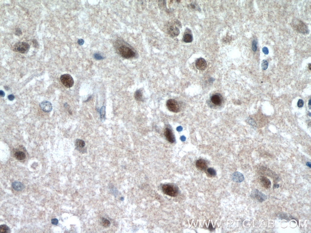 IHC staining of human brain using 12439-1-AP