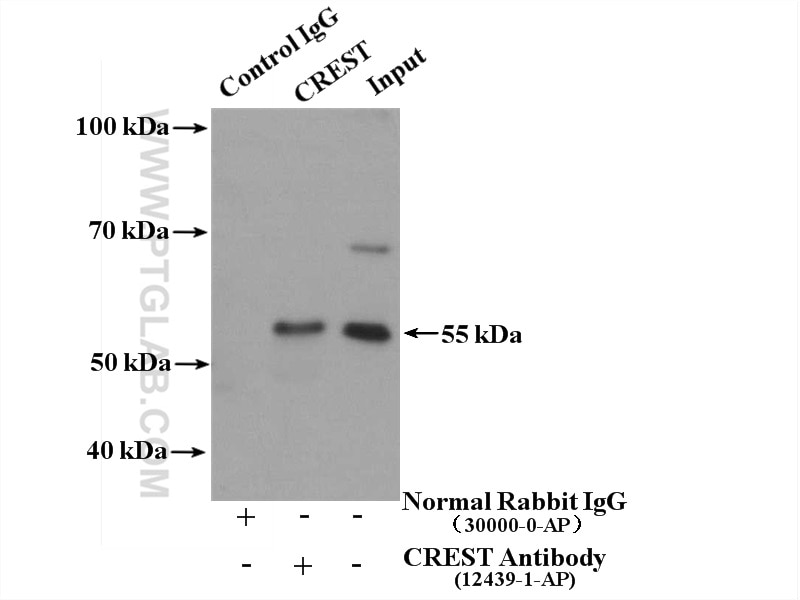Immunoprecipitation (IP) experiment of HeLa cells using CREST Polyclonal antibody (12439-1-AP)