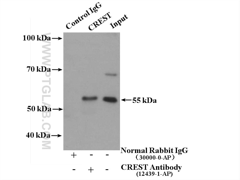 IP experiment of HeLa using 12439-1-AP