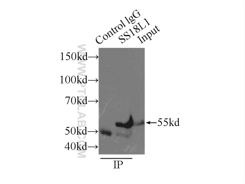 IP experiment of mouse brain using 12439-1-AP