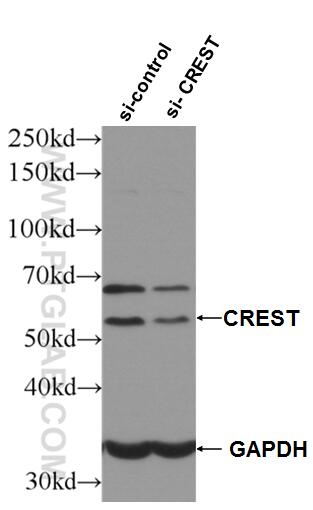 Western Blot (WB) analysis of HeLa cells using CREST Polyclonal antibody (12439-1-AP)