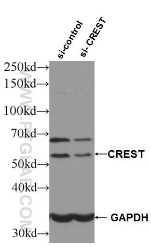 WB analysis of HeLa using 12439-1-AP