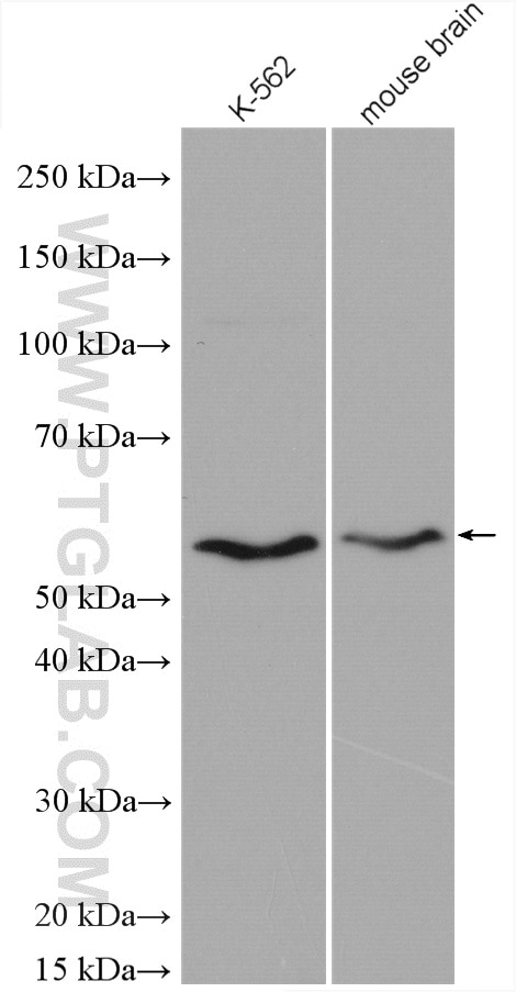 Western Blot (WB) analysis of various lysates using CREST Polyclonal antibody (12439-1-AP)