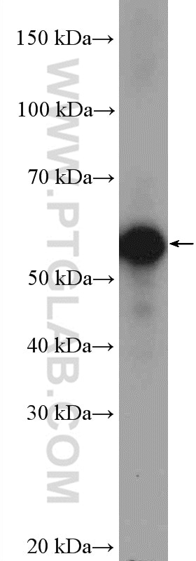 Western Blot (WB) analysis of mouse brain tissue using CREST Polyclonal antibody (12439-1-AP)