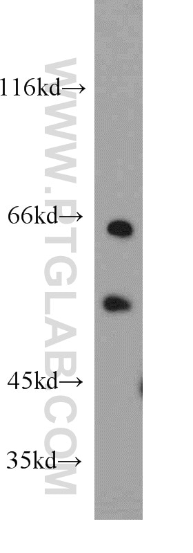 Western Blot (WB) analysis of COLO 320 cells using CREST Polyclonal antibody (12439-1-AP)