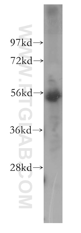 Western Blot (WB) analysis of human heart tissue using CREST Polyclonal antibody (12439-1-AP)