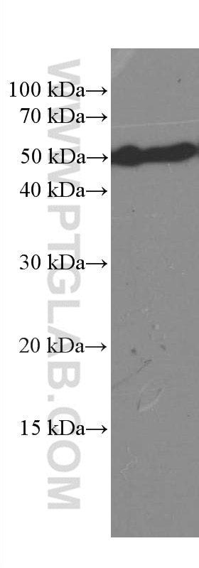Western Blot (WB) analysis of COLO 320 cells using CREST Monoclonal antibody (60314-1-Ig)