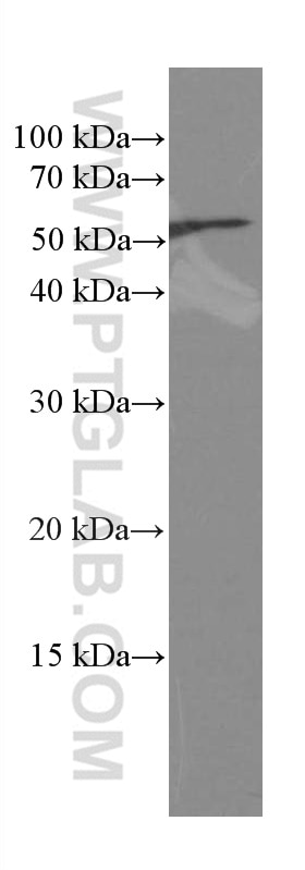 Western Blot (WB) analysis of RAW 264.7 cells using CREST Monoclonal antibody (60314-1-Ig)