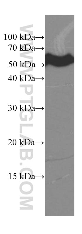 Western Blot (WB) analysis of MCF-7 cells using CREST Monoclonal antibody (60314-1-Ig)