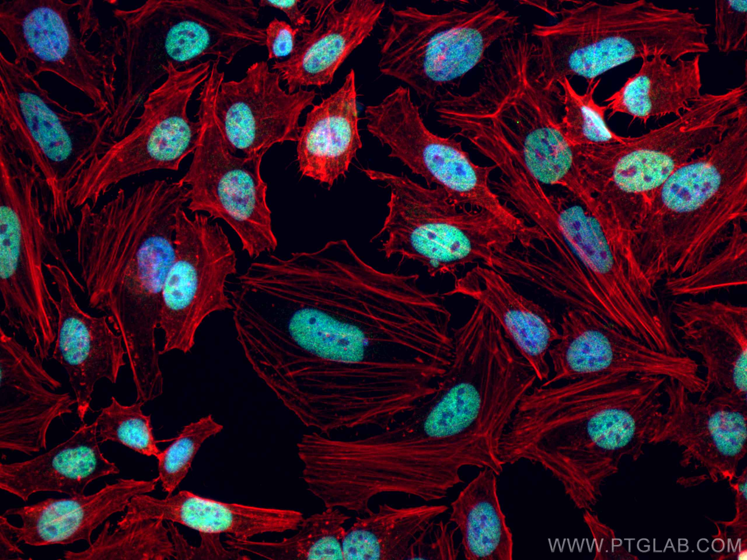 Immunofluorescence (IF) / fluorescent staining of HeLa cells using CoraLite® Plus 488-conjugated CREST Polyclonal ant (CL488-12439)