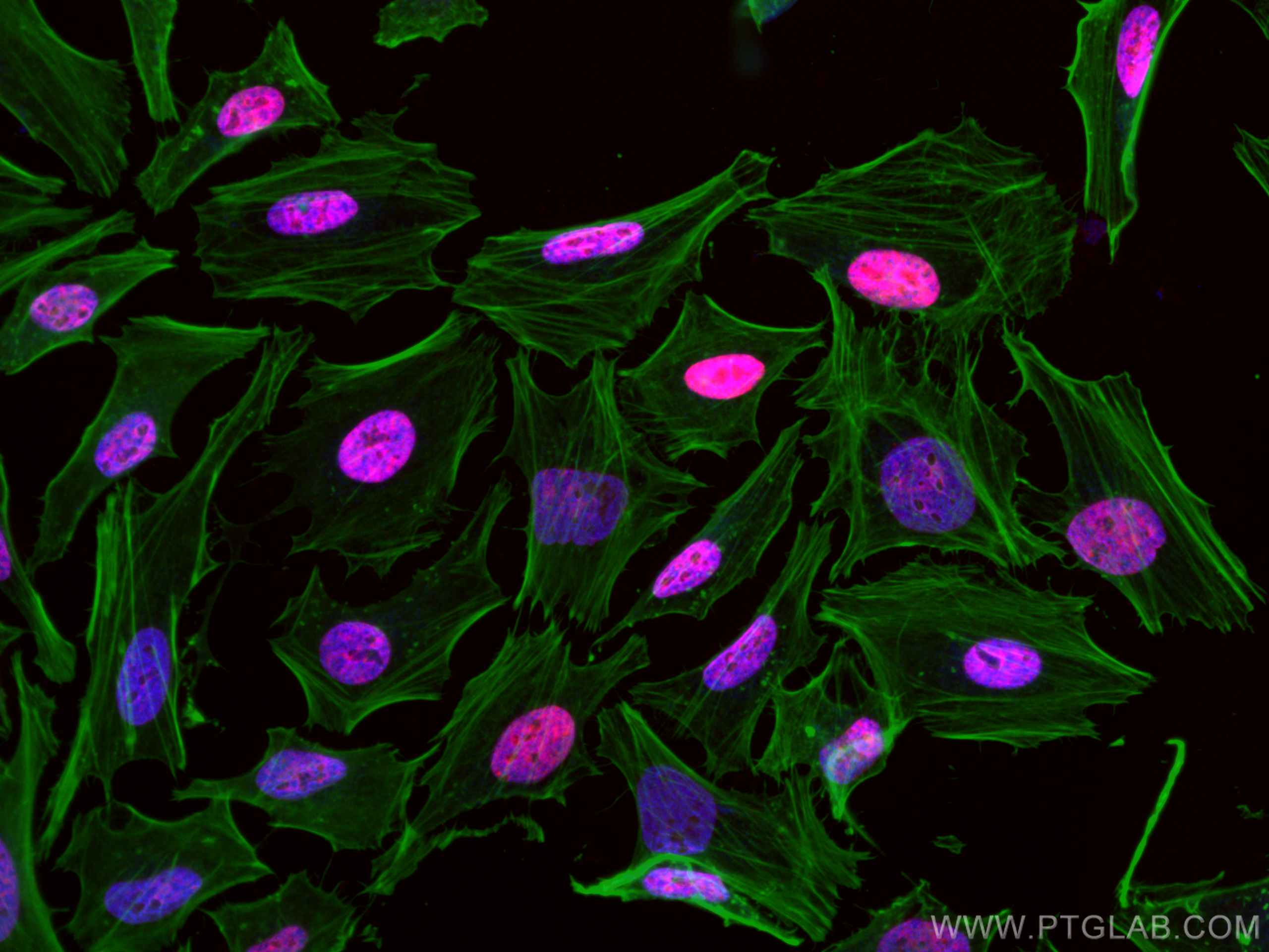Immunofluorescence (IF) / fluorescent staining of HeLa cells using CoraLite®594-conjugated CREST Polyclonal antibody (CL594-12439)