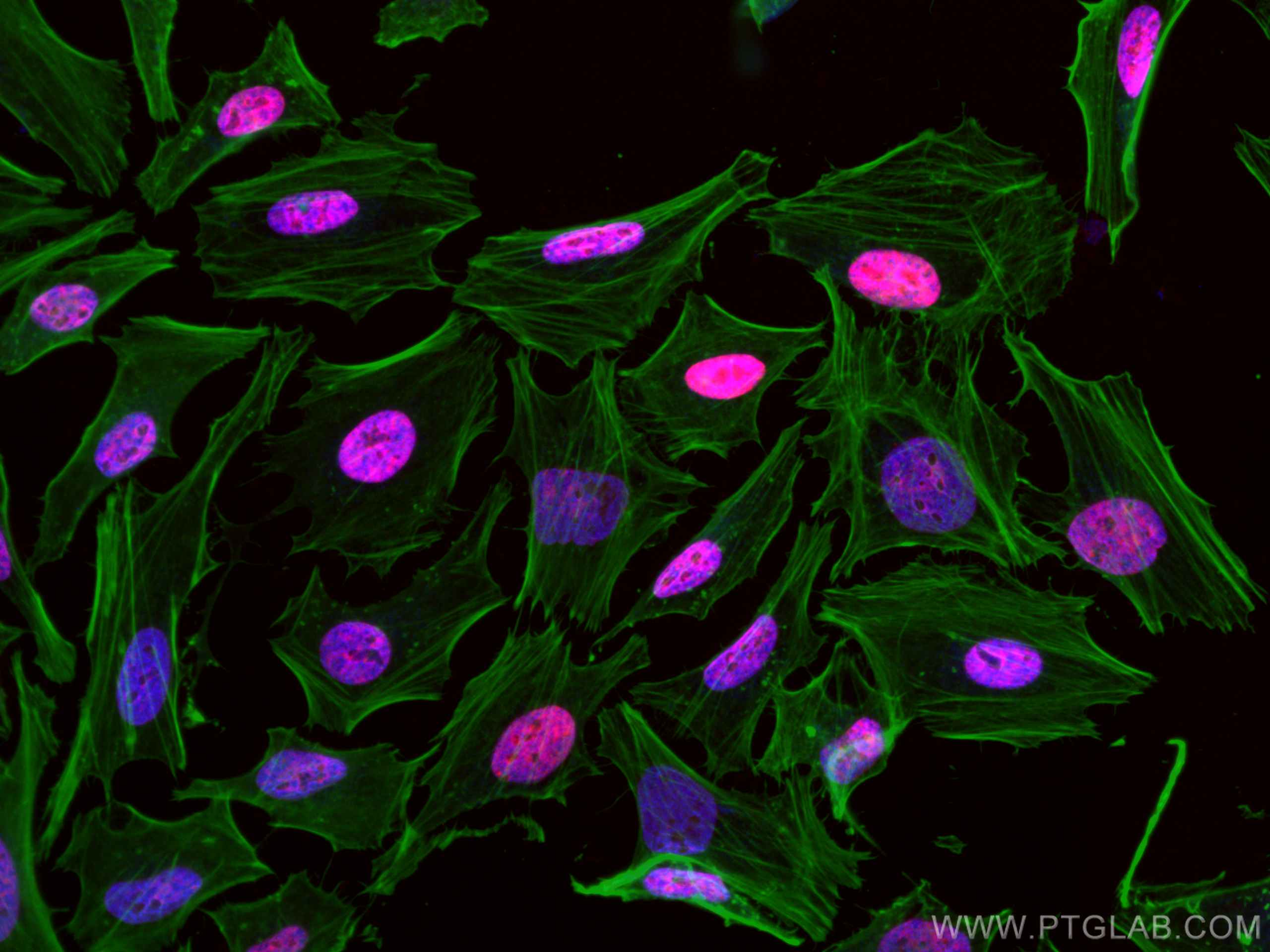 IF Staining of HeLa using CL594-12439