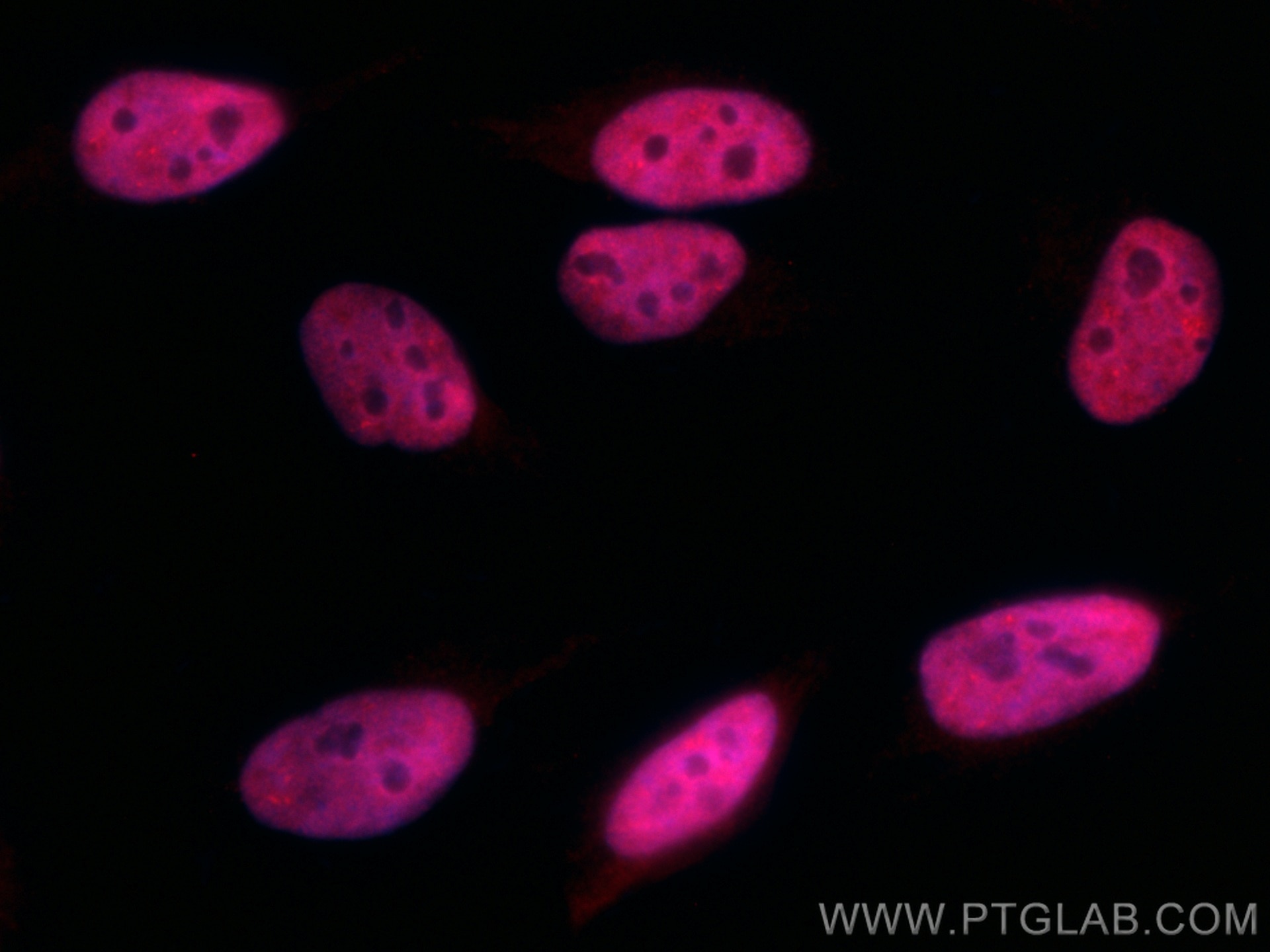 Immunofluorescence (IF) / fluorescent staining of HeLa cells using CoraLite®594-conjugated CREST Polyclonal antibody (CL594-12439)