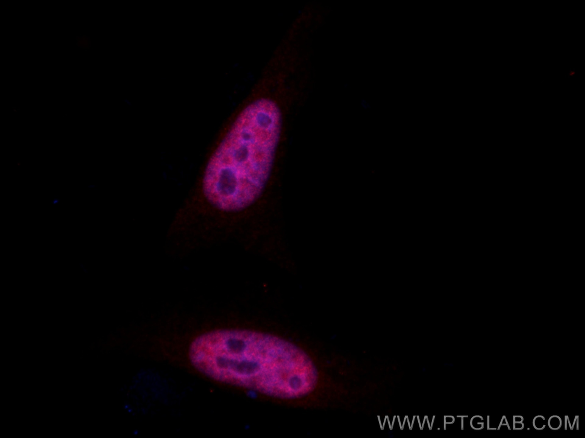 IF Staining of HeLa using CL594-12439