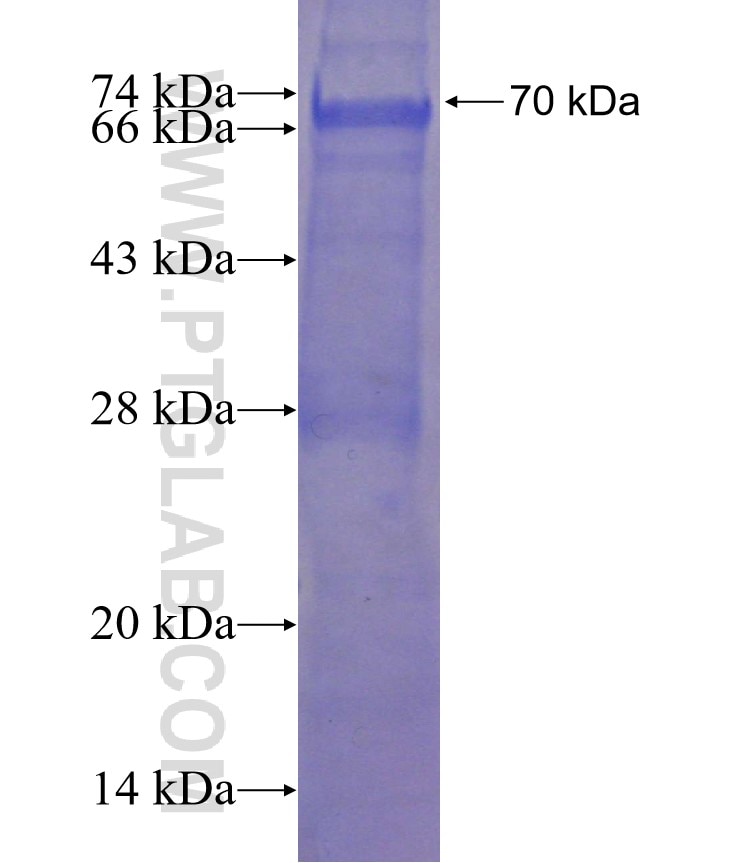 CREST fusion protein Ag3119 SDS-PAGE