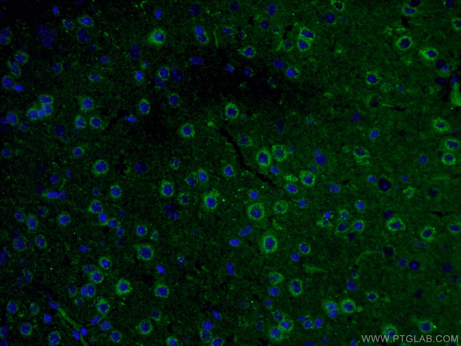 Immunofluorescence (IF) / fluorescent staining of mouse brain tissue using CRH/CRF Polyclonal antibody (10944-1-AP)