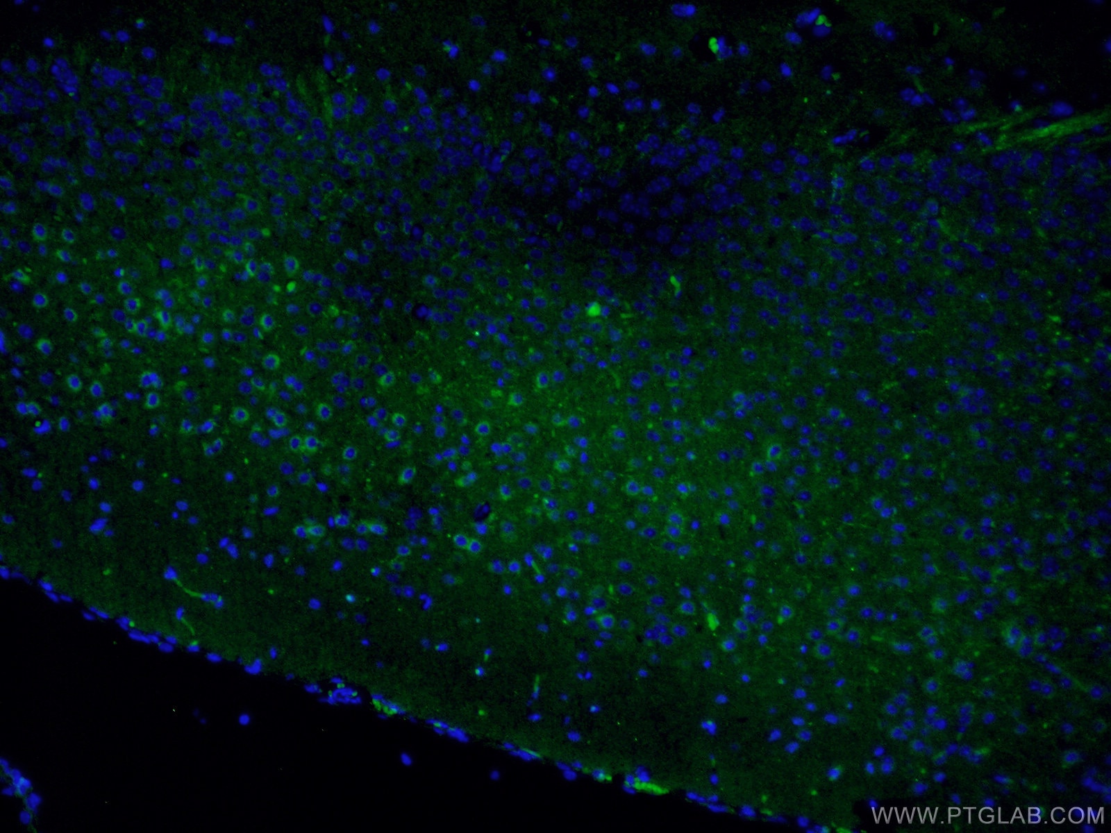 Immunofluorescence (IF) / fluorescent staining of mouse brain tissue using CRH/CRF Polyclonal antibody (10944-1-AP)