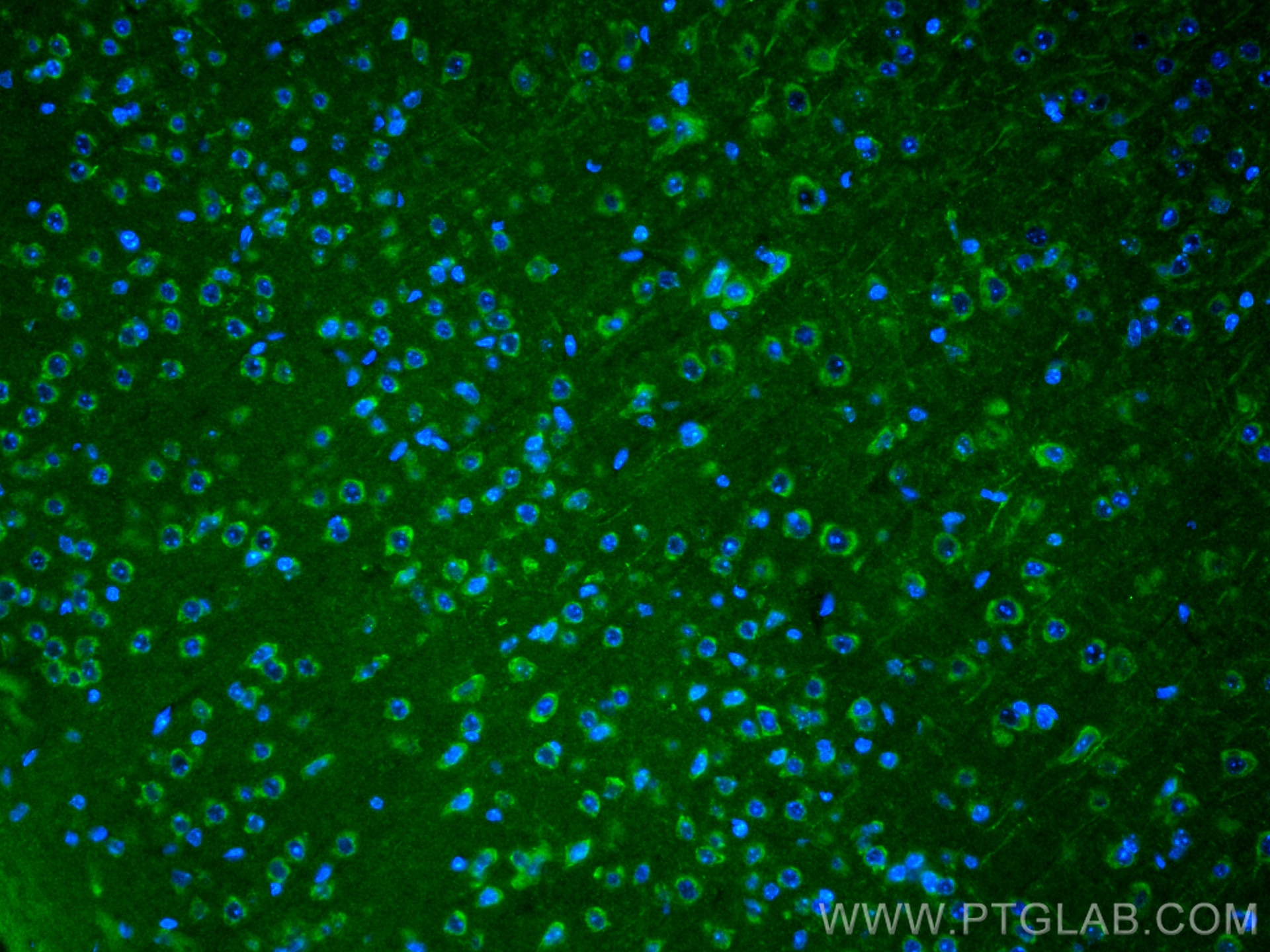 Immunofluorescence (IF) / fluorescent staining of mouse brain tissue using CRH/CRF Polyclonal antibody (10944-1-AP)
