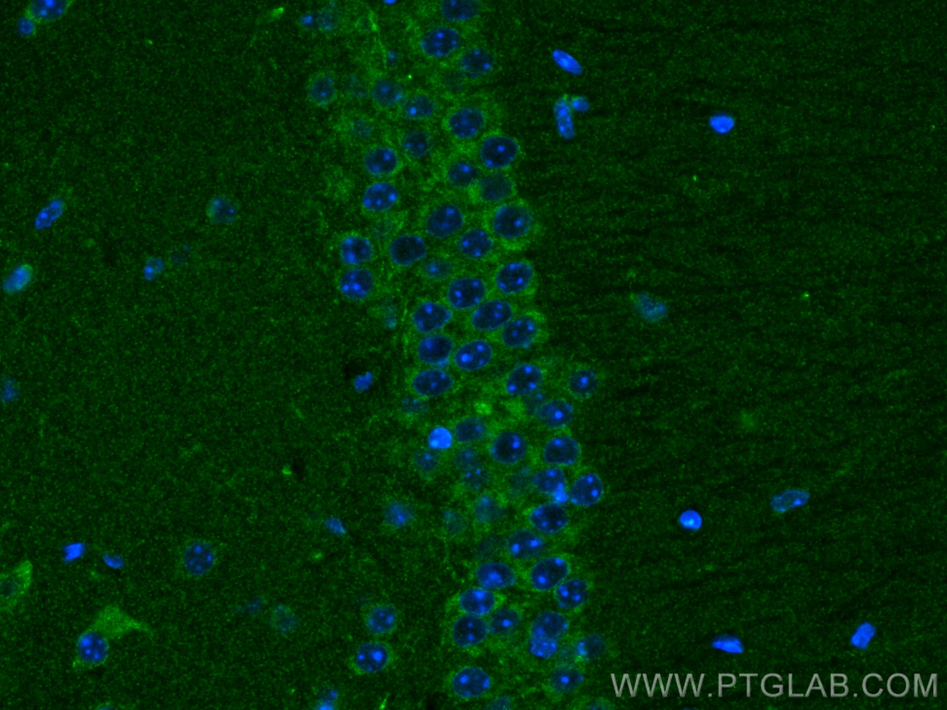 IF Staining of mouse brain using 10944-1-AP