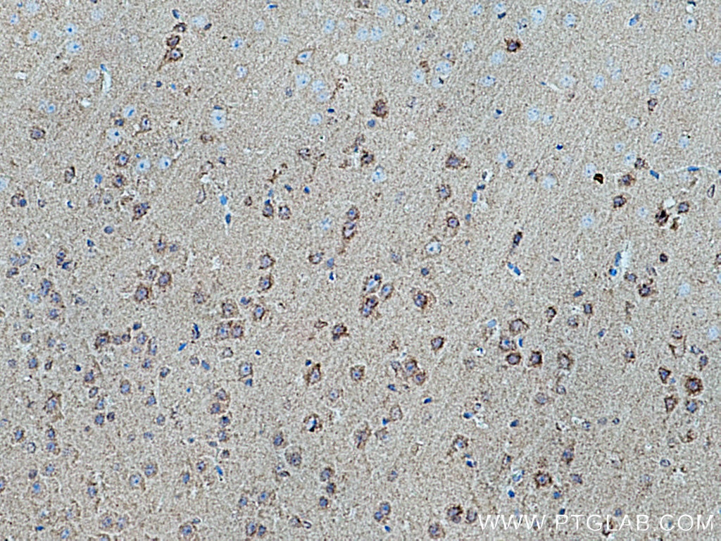 Immunohistochemistry (IHC) staining of mouse brain tissue using CRH/CRF Polyclonal antibody (10944-1-AP)